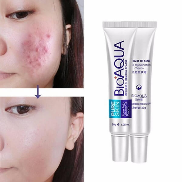 Bioaqua Acne Removal Cream